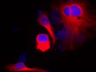 想做免疫荧光不会细胞爬片怎么行?