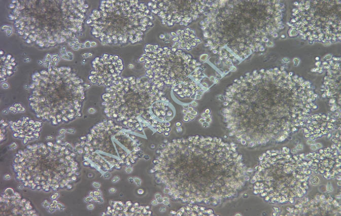 逸漠NK-92人恶性非霍奇金淋巴瘤患者的自然杀伤细胞