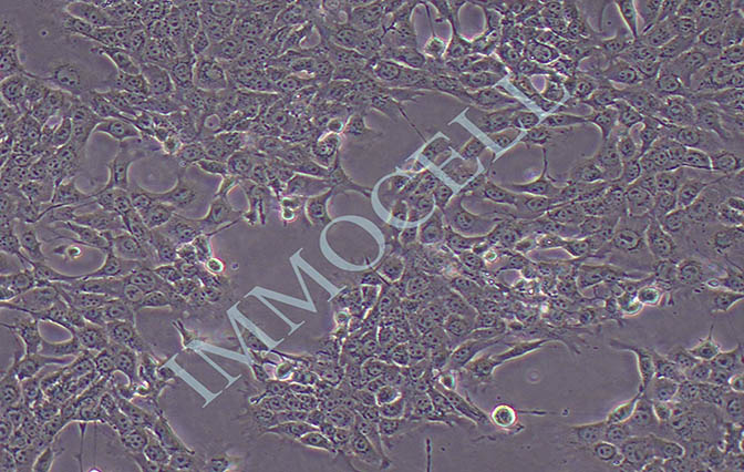 MB49小鼠膀胱癌细胞 