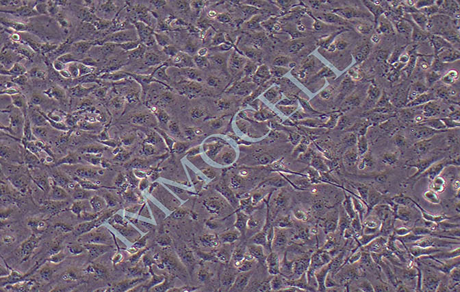 ID8小鼠卵巢上皮癌细胞