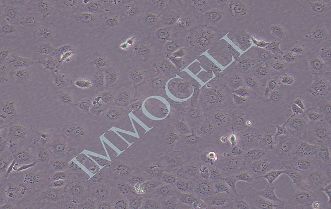 MPC-5小鼠肾足细胞