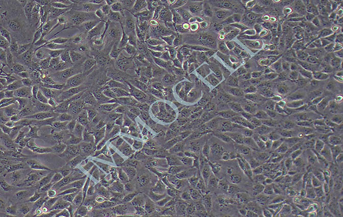 ID8小鼠卵巢上皮癌细胞