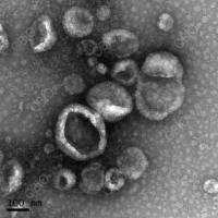 外泌体(exosomes)分离和鉴定