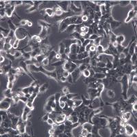 MFE-280 人子宫内膜腺癌细胞