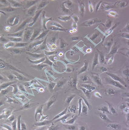 Caki-1(人肾透明细胞癌皮肤转移细胞)丨Caki-1细胞(STR鉴定)丨逸漠