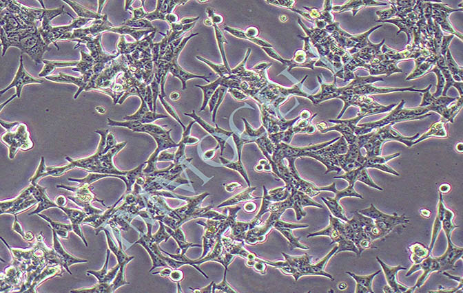 LNCAP人前列腺癌细胞