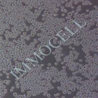 RPMI 8226【人多发性骨髓瘤外周血B淋巴细胞】RPMI8226(STR谱定)