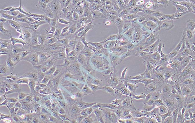 769-P人肾细胞腺癌细胞 