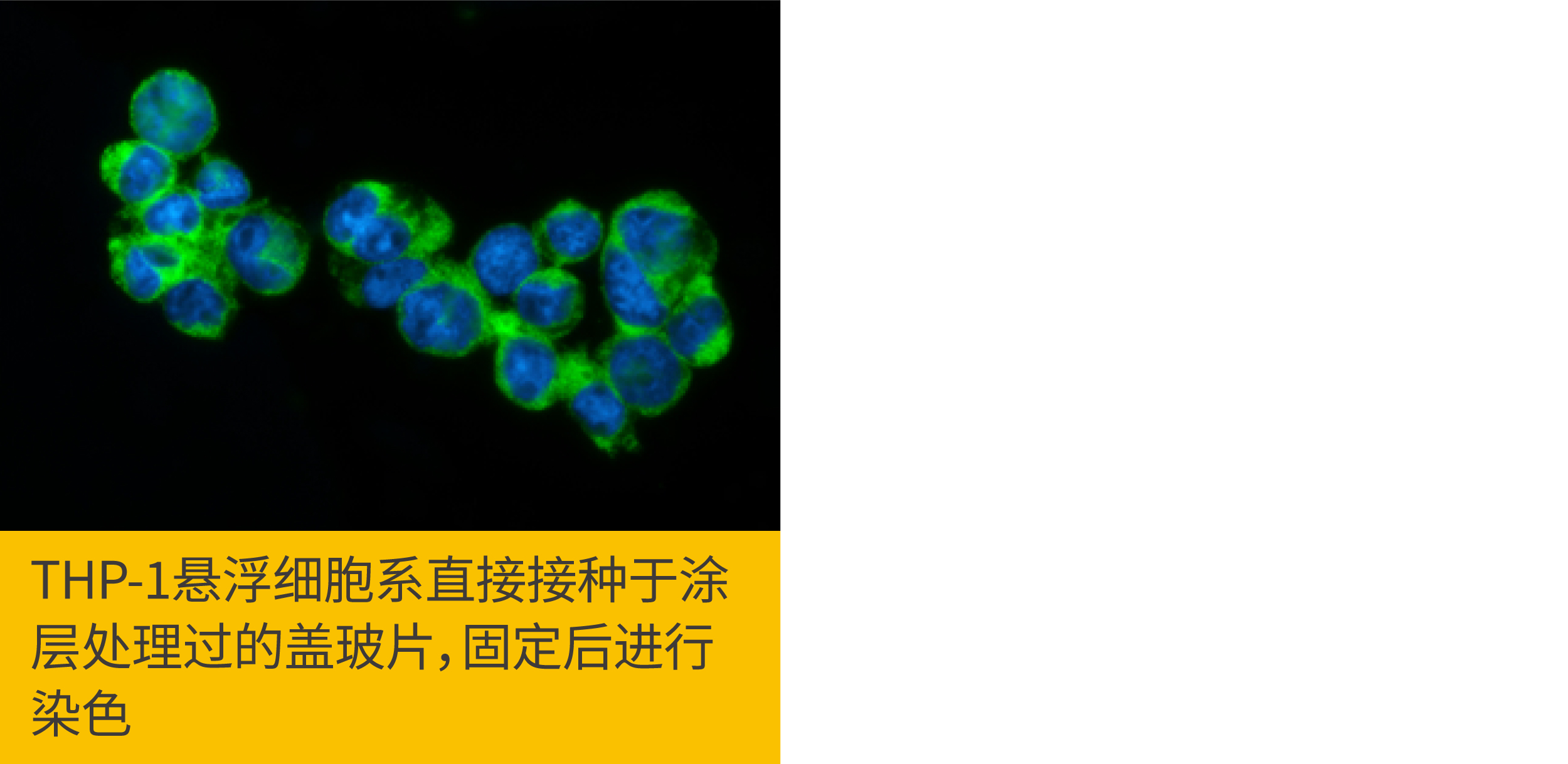 2个ICC/IF染色位置错误该做的事