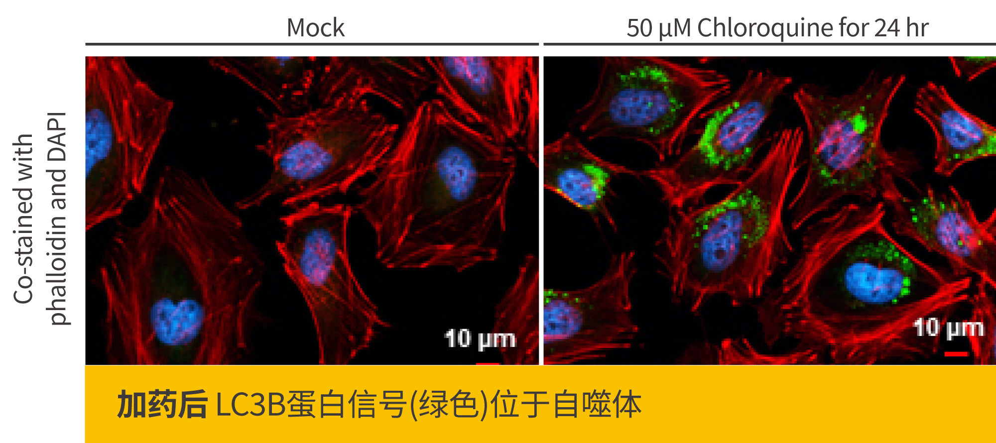 2个ICC/IF染色位置错误该做的事