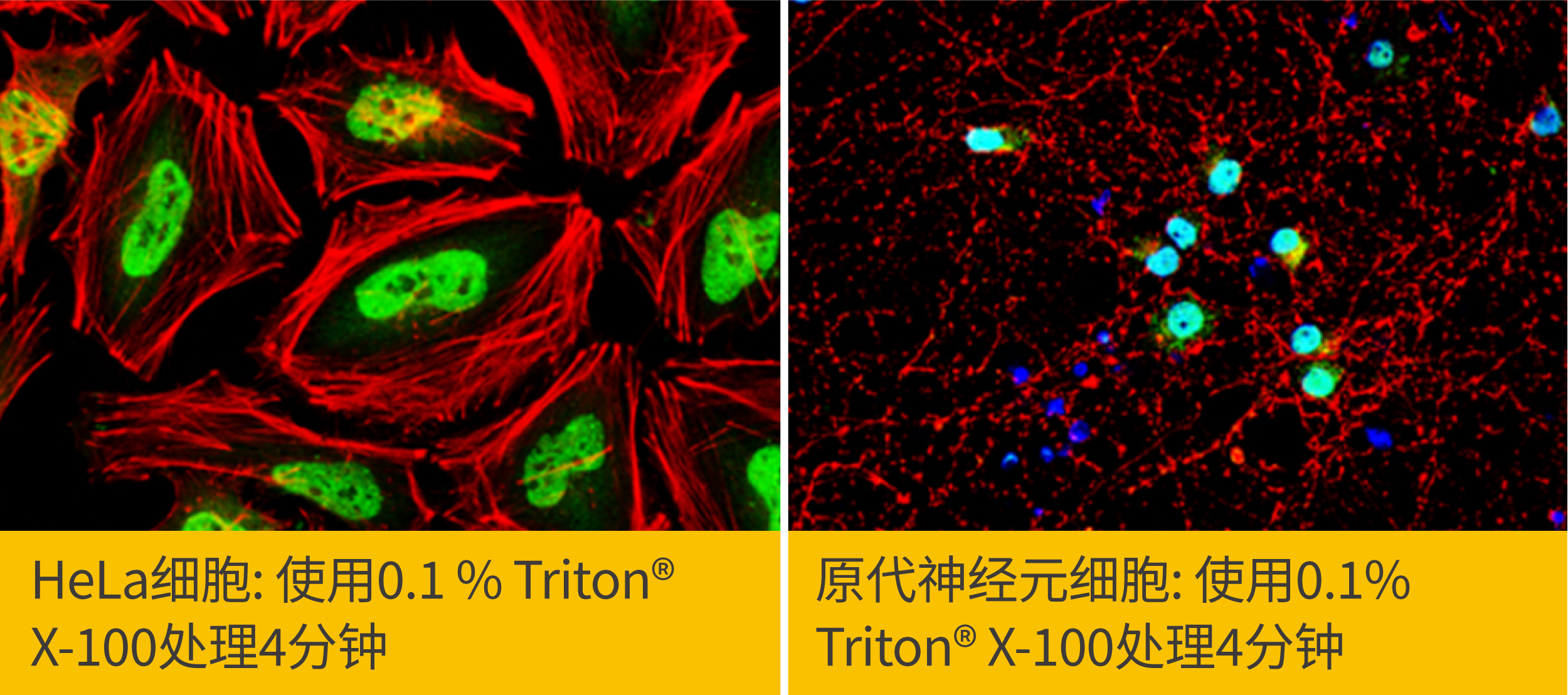 2个ICC/IF染色位置错误该做的事