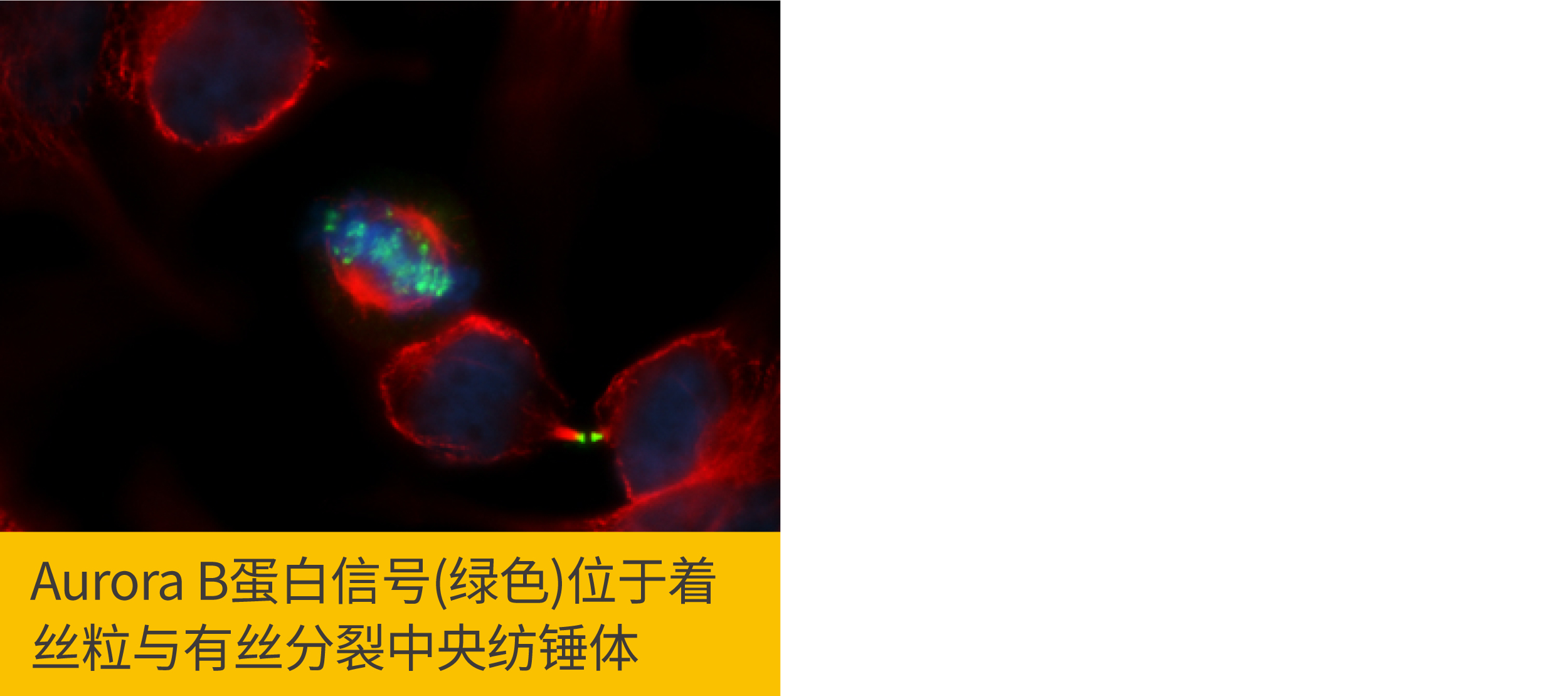 2个ICC/IF染色位置错误该做的事