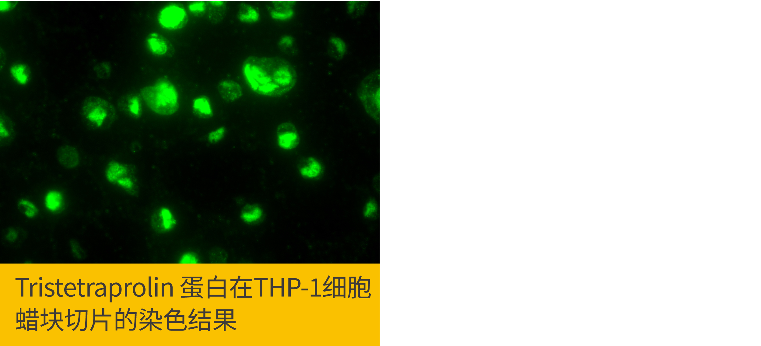 2个ICC/IF染色位置错误该做的事