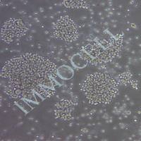 Jurkat，Clone E6-1人T淋巴细胞白血病细胞(含STR)丨Jurkat，Clone E6-1