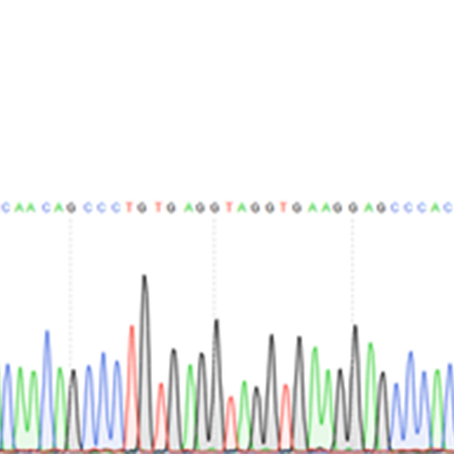  lncRNA、circRNA、mRNA qRT-PCR检测