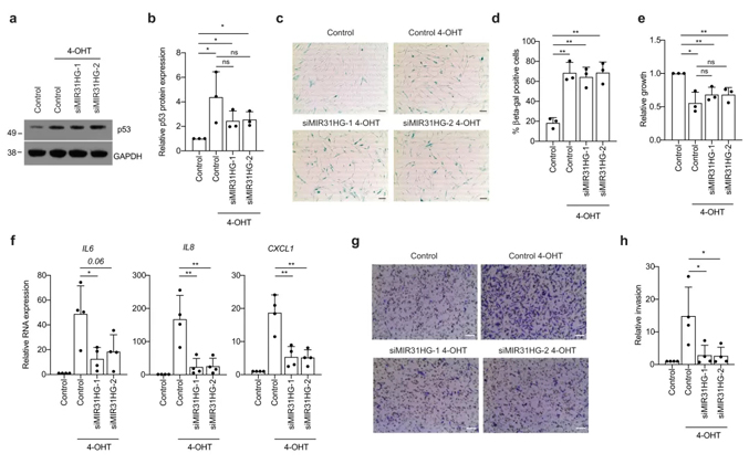 Nature子刊丨lncRNA MIR31HG调控衰老相关分泌表型，可作为衰老相关疾病潜在治疗靶标