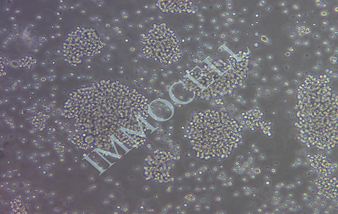 Jurkat,Clone E6-1人T淋巴细胞白血病细胞