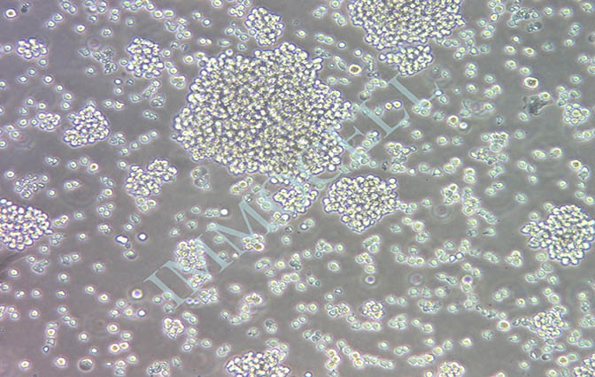 Jurkat,Clone E6-1人T淋巴细胞白血病细胞