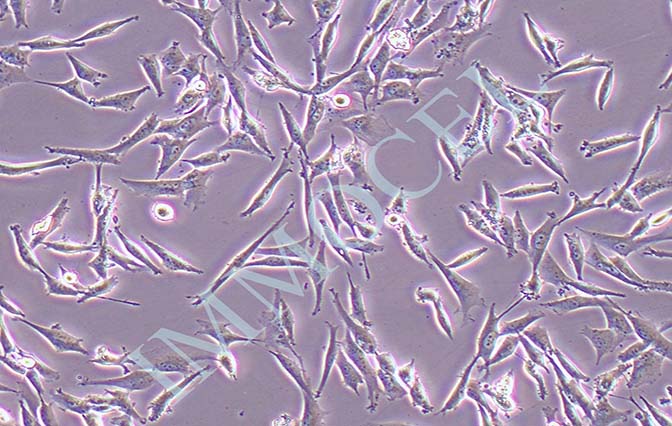 HS683人脑胶质瘤细胞