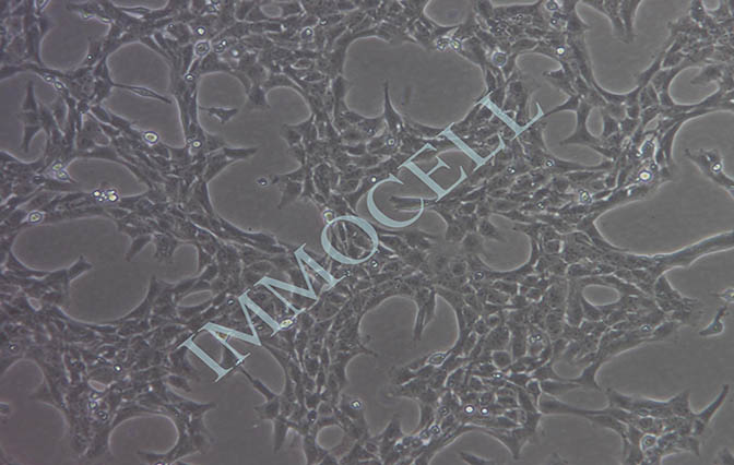 LX-2人肝星形细胞