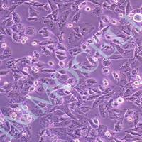 NCI-H1703人肺鳞癌细胞丨NCI-H1703细胞系(STR鉴定)