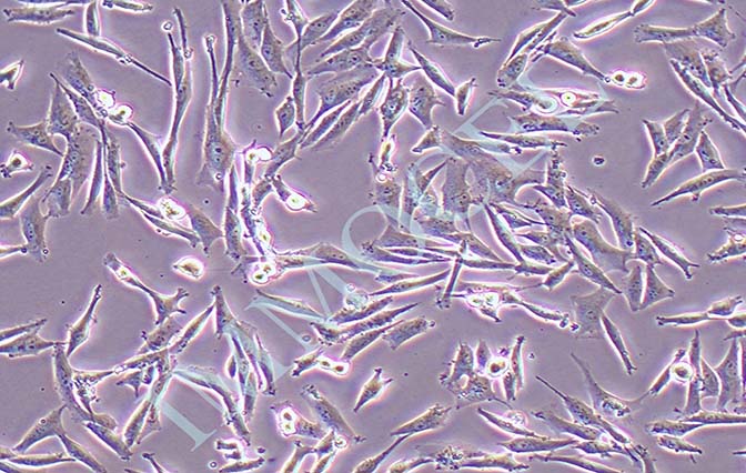 HS683人脑胶质瘤细胞