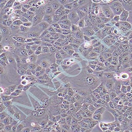 MKN28人胃癌细胞(STR鉴定)丨mkn28细胞