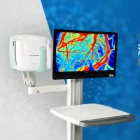 激光散斑血流成像仪--SIM BFI ZOOM