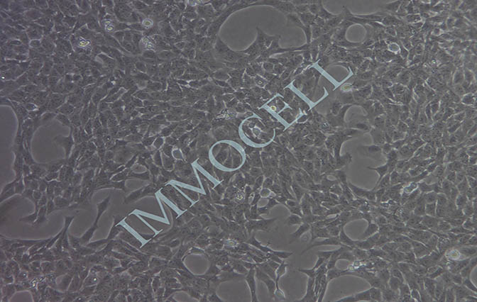 LX-2人肝星形细胞