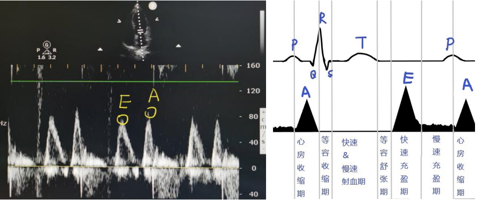 心脏超声报告不会看？先熟记这 6 大指标！ 丁香园eow 3121