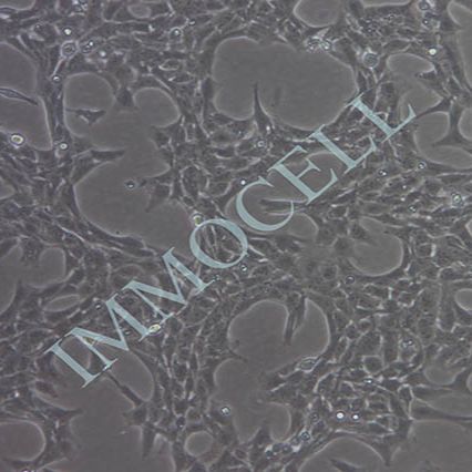 LX-2人肝星形细胞丨LX-2细胞株(STR鉴定)