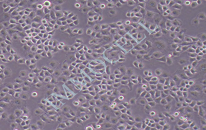 HO-8910PM人卵巢癌细胞
