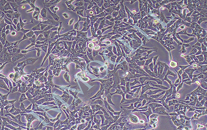 VCaP人前列腺癌细胞