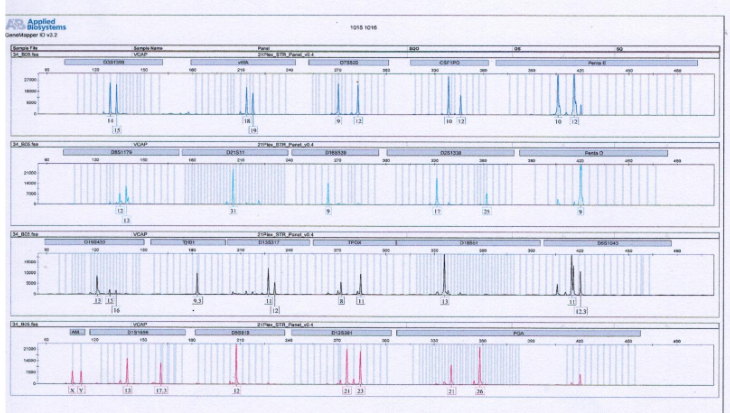 VCaP人前列腺癌细胞 str鉴定