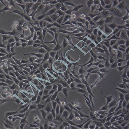 HGC-27人胃癌细胞（未分化）丨HGC-27细胞株(STR鉴定)