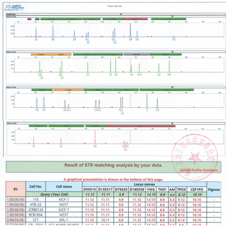 MCF-7人乳腺癌细胞 str鉴定