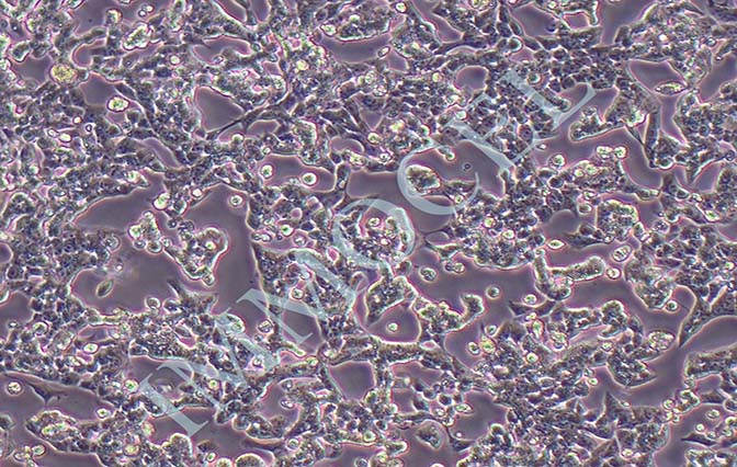 RL95-2人子宫内膜癌细胞
