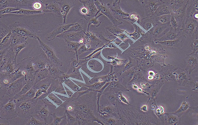 786-O人肾透明细胞癌细胞