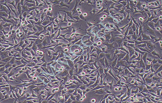 Bel-7405人肝癌细胞
