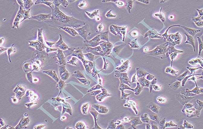 HCC-LM3高转移人肝癌细胞
