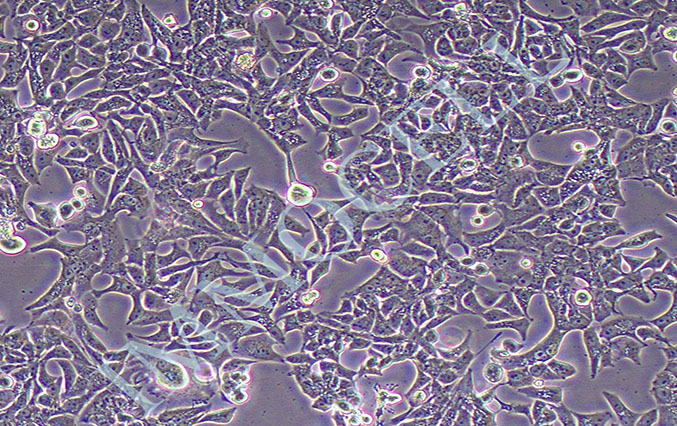 VCaP人前列腺癌细胞