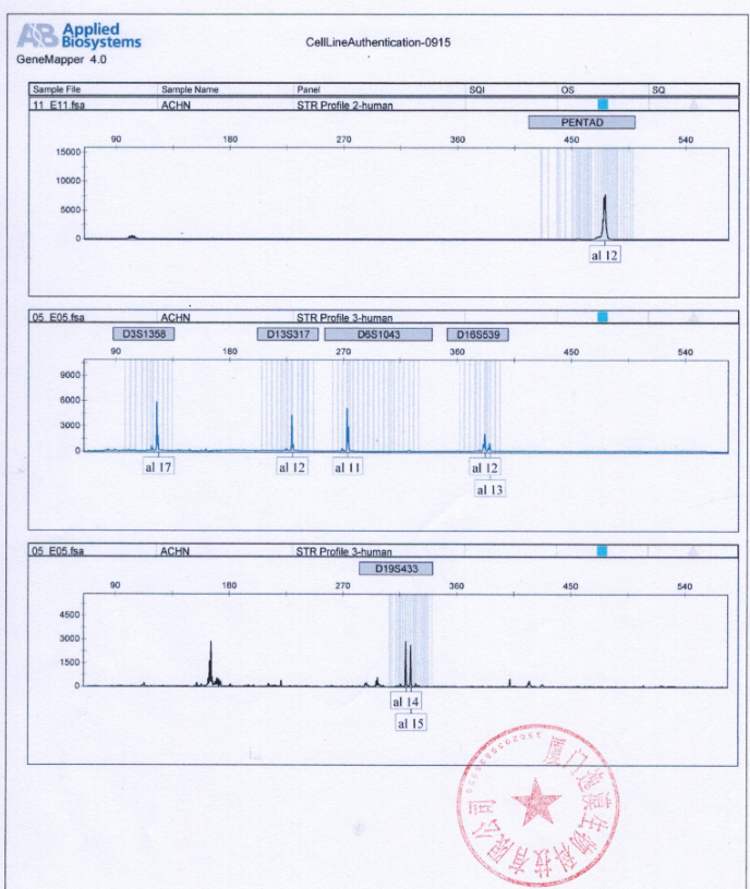 ACHN人肾癌细胞 str鉴定