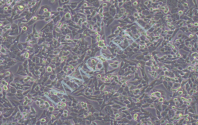 Hep G2.2.15人肝癌(HBV)