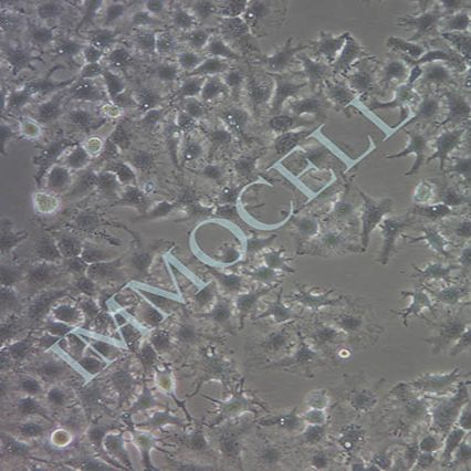huh-7人肝癌细胞(STR鉴定)丨huh-7细胞系