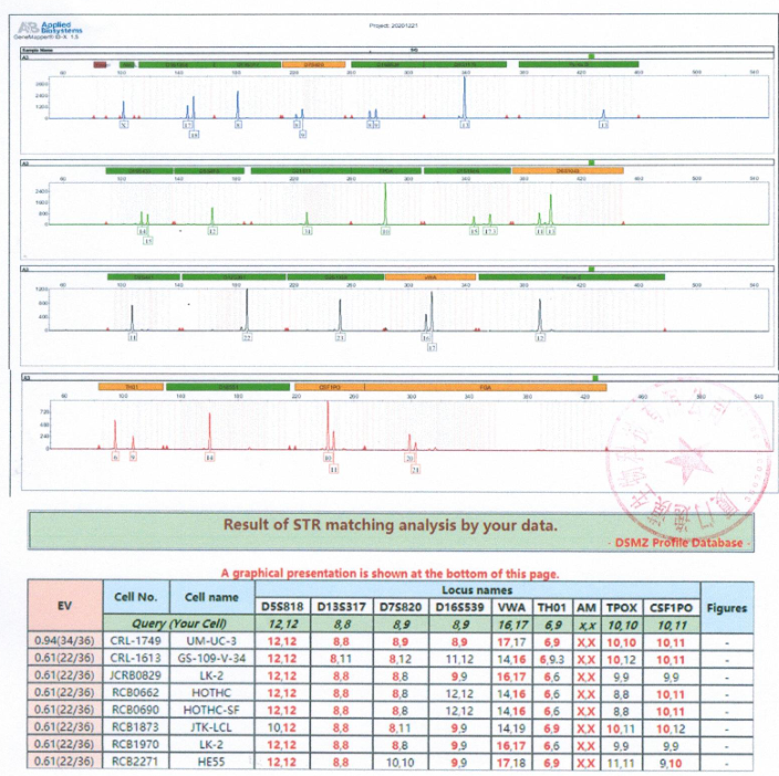 UM-UC-3人膀胱移行细胞癌 str鉴定