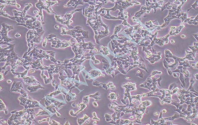RL95-2人子宫内膜癌细胞