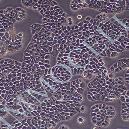 HT-29人结肠癌细胞(STR鉴定)丨ht29细胞丨逸漠(immocell)