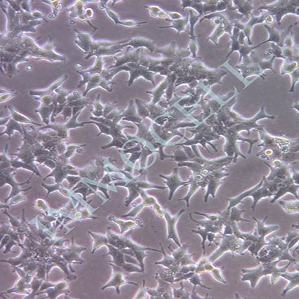 22Rv1人前列腺癌细胞丨22rv1细胞丨[22rv1]