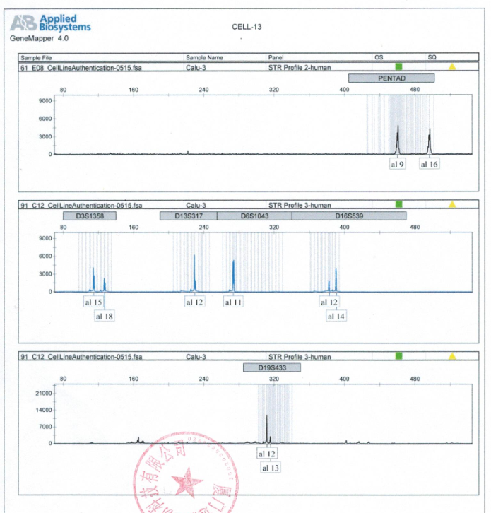 Calu-3人肺癌细胞(STR鉴定)