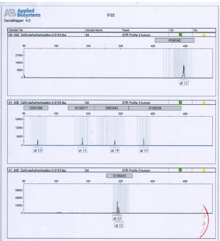 FTC-133人甲状腺癌细胞(STR鉴定)